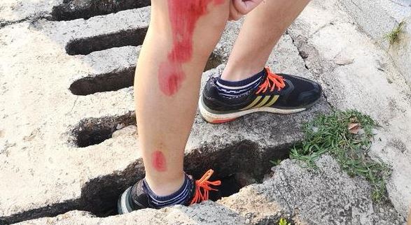 水泥盖板破损造成人受伤